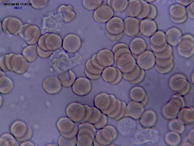 Glóbulos rojos y blancos